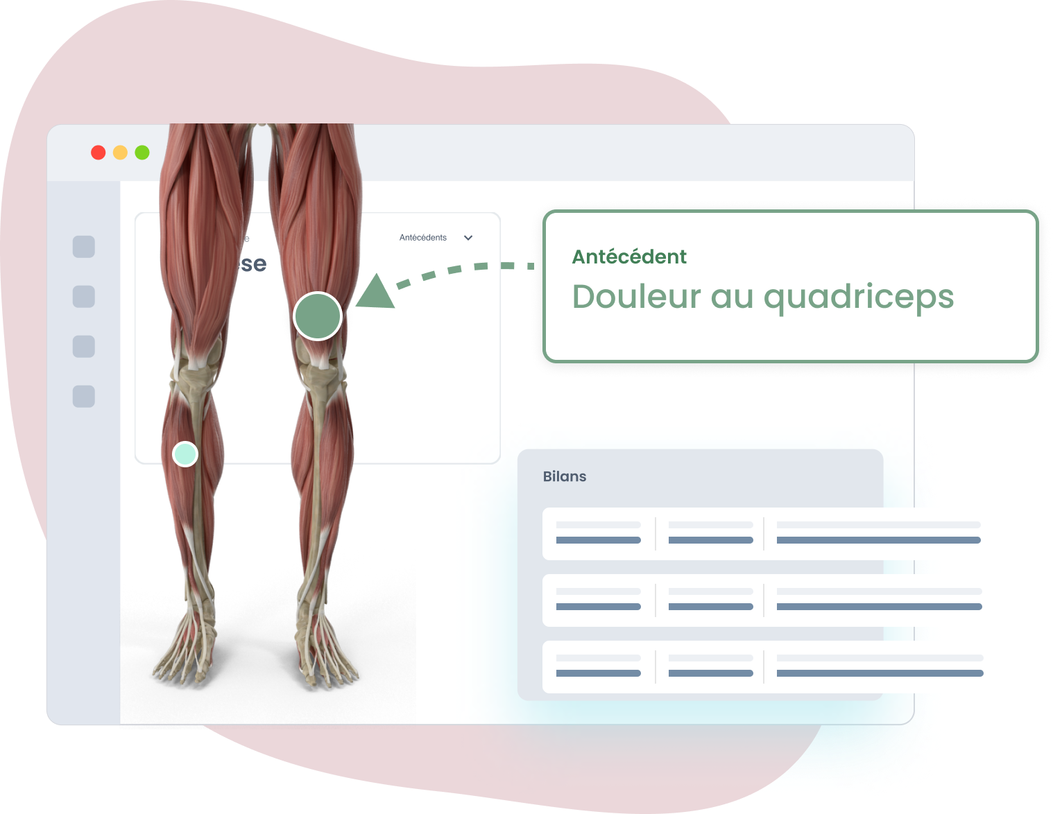 accàs facile aux données des patients pour logiciel podo